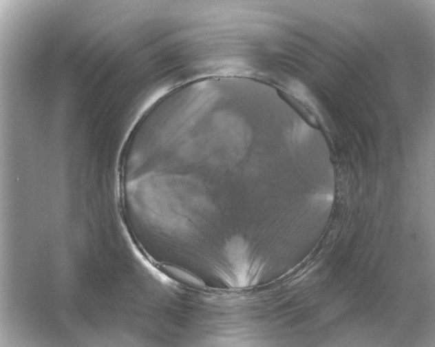 X0000066011095200603312016