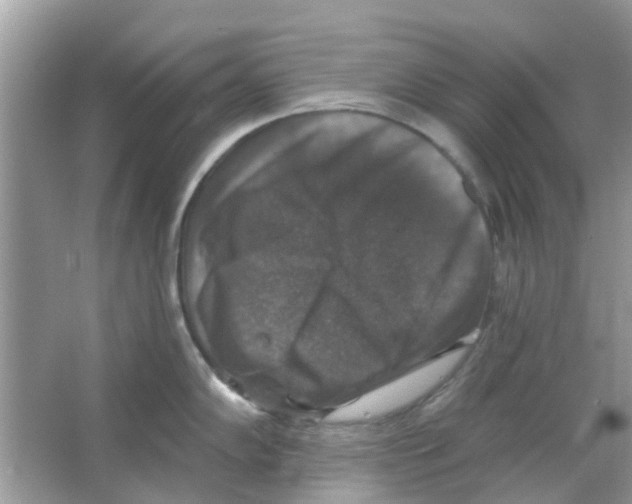 X0000066011102200603312016
