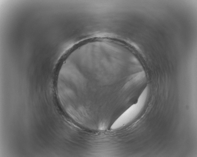 X0000066011263200603312014