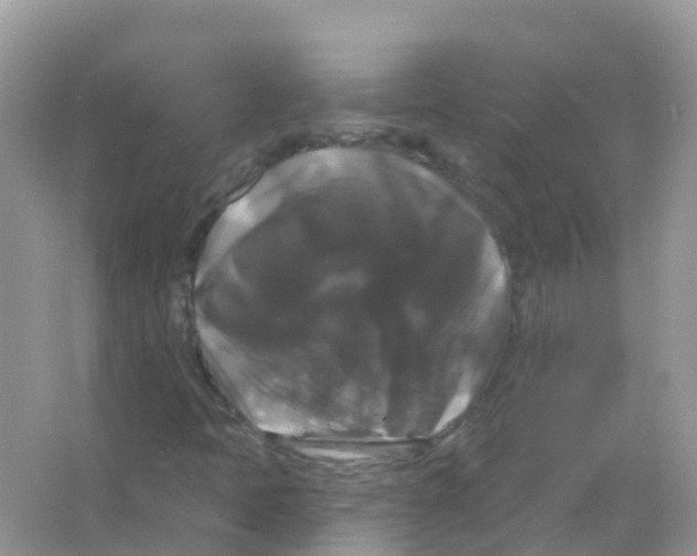 X0000066011397200603312011