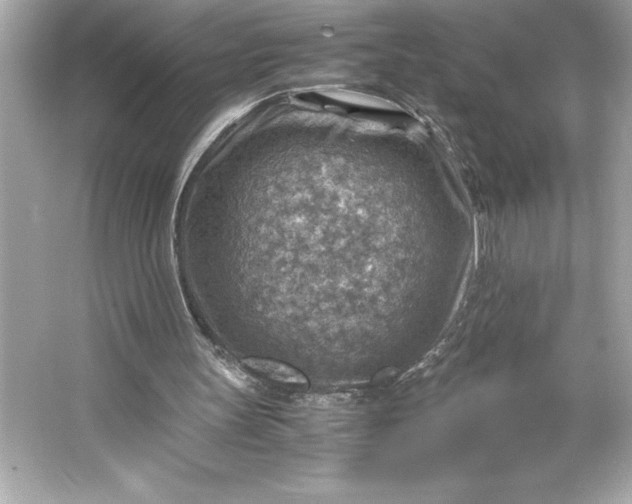 X0000066020147200603171541