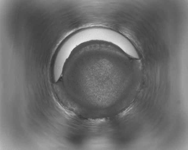 X0000066020156200603171541