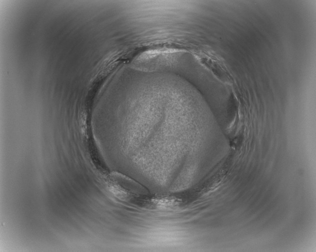 X0000066020693200603171532