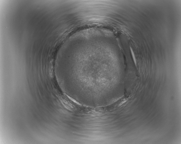 X0000066020868200603171529