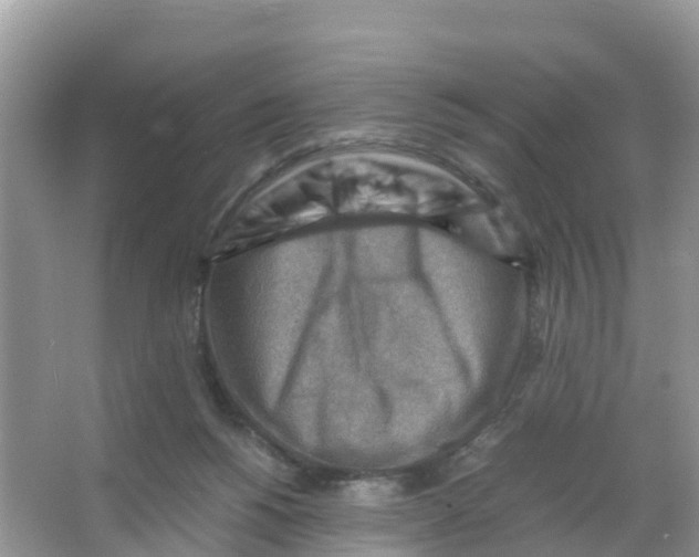 X0000066020168200603312058