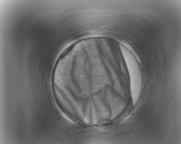 X0000066021197200603312041