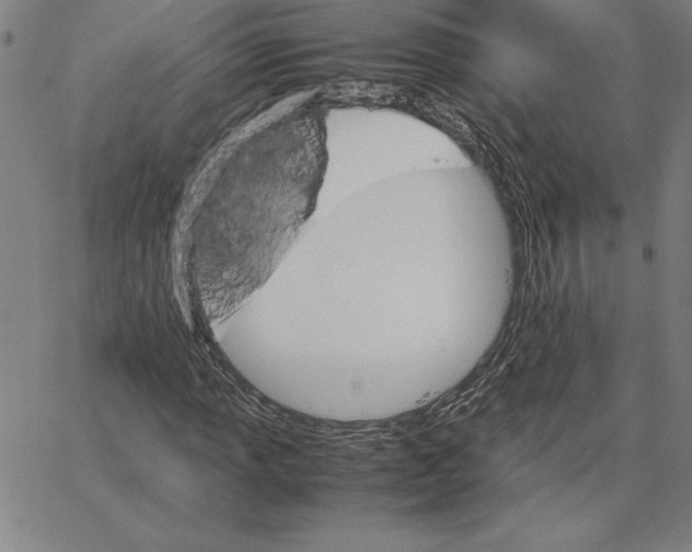 X0000066081013200604071726