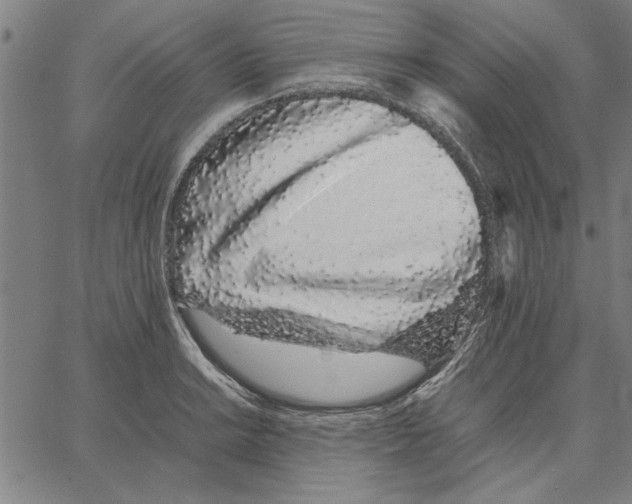 X0000066081038200604071727