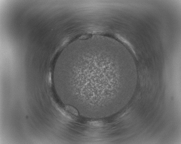 X0000066100067200603171407