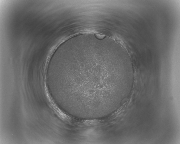 X0000066100145200603171405