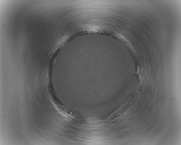 X0000066100496200603171400