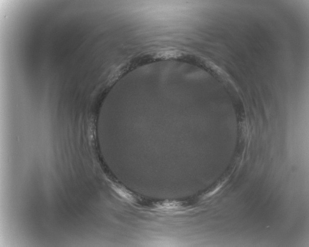 X0000066100517200603171400