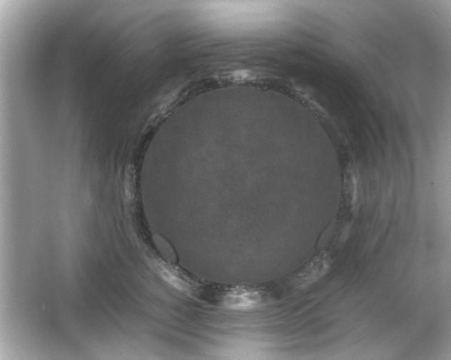 X0000066100760200603171356