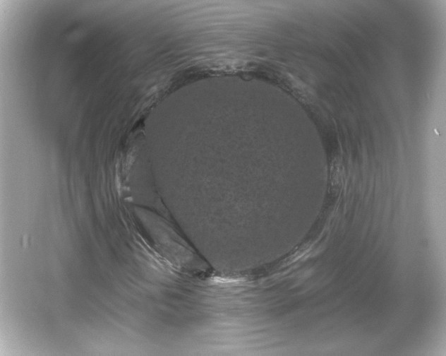 X0000066101202200603171348