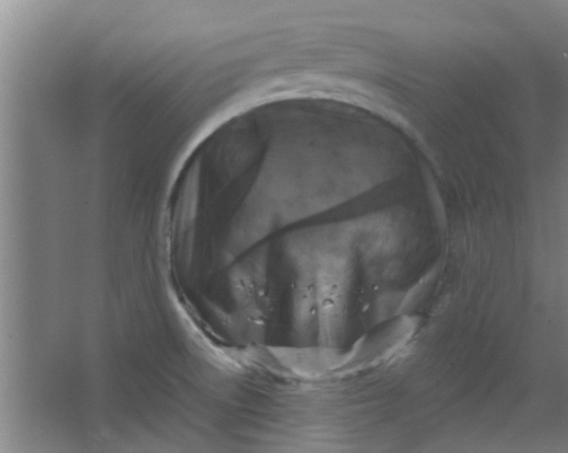 X0000066101522200603241505