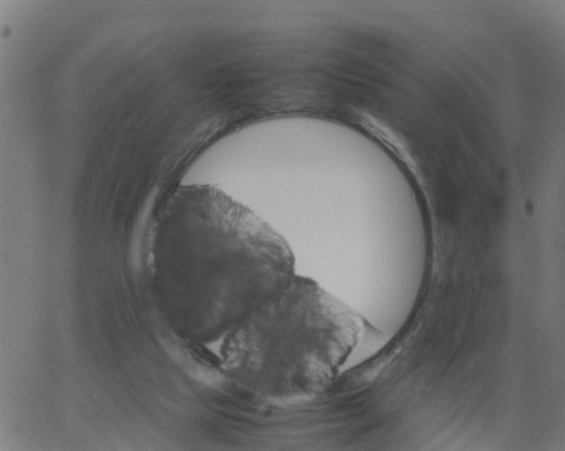 X0000066100065200603312035