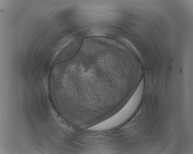 X0000066100386200603312030