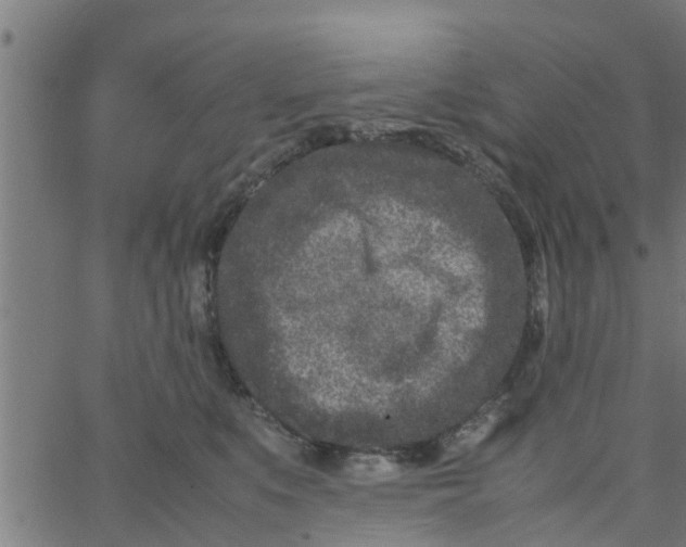 X0000066100519200603312028