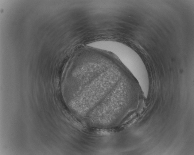 X0000066100565200603312028