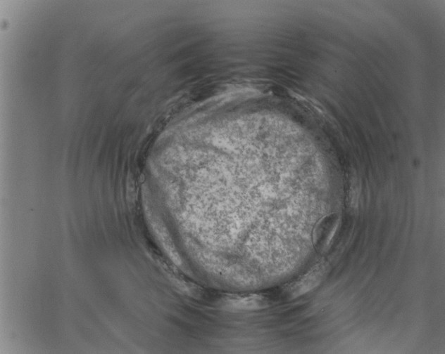 X0000066100569200603312028