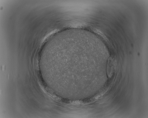 X0000066100587200603312027