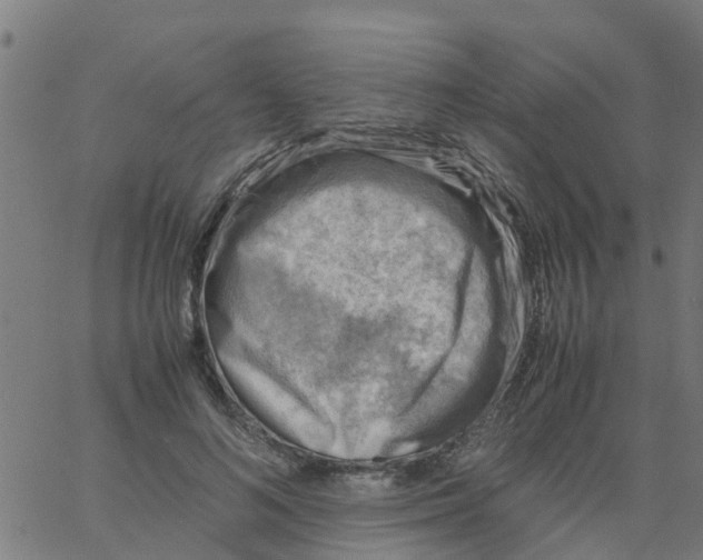 X0000066100692200603312025