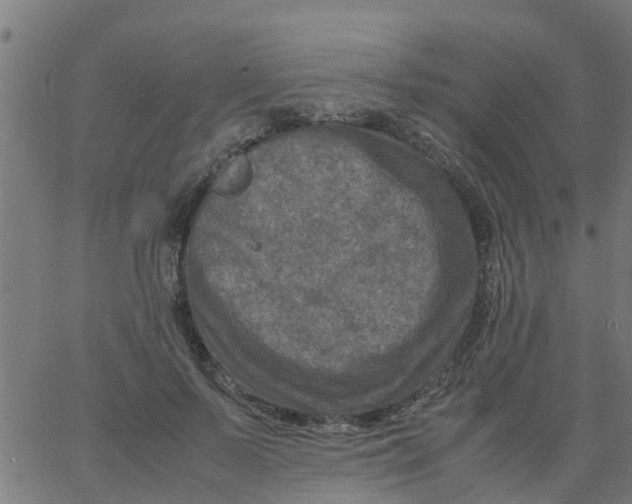 X0000066100695200603312025