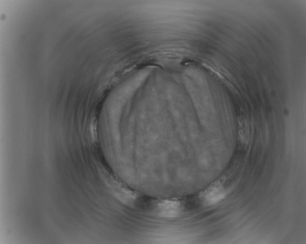 X0000066100718200603312025