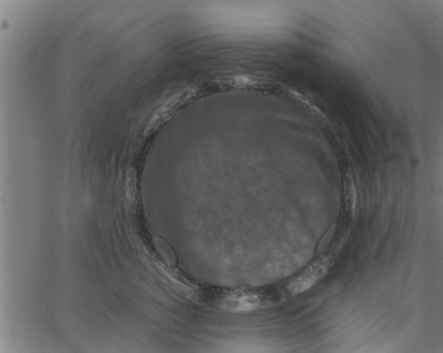 X0000066100760200603312025