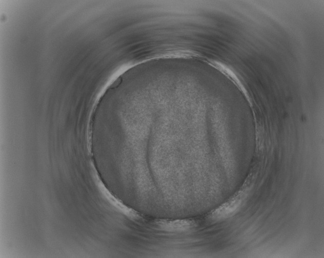 X0000066100851200603312023