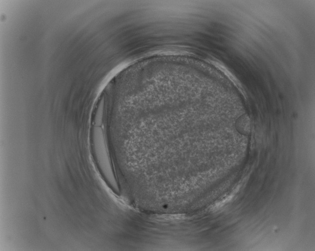 X0000066100853200603312023