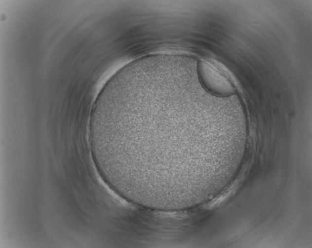 X0000066100855200603312023