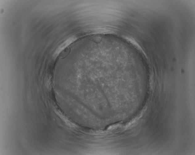 X0000066100873200603312023