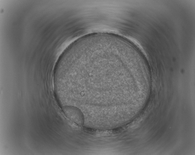 X0000066100887200603312022