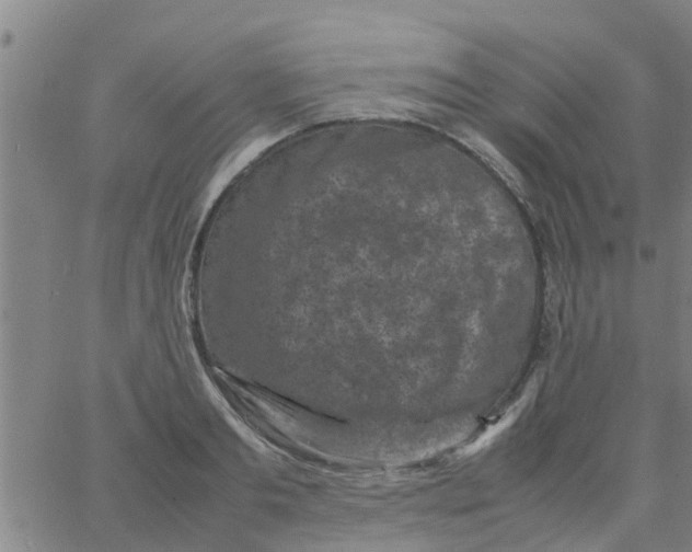 X0000066100893200603312022