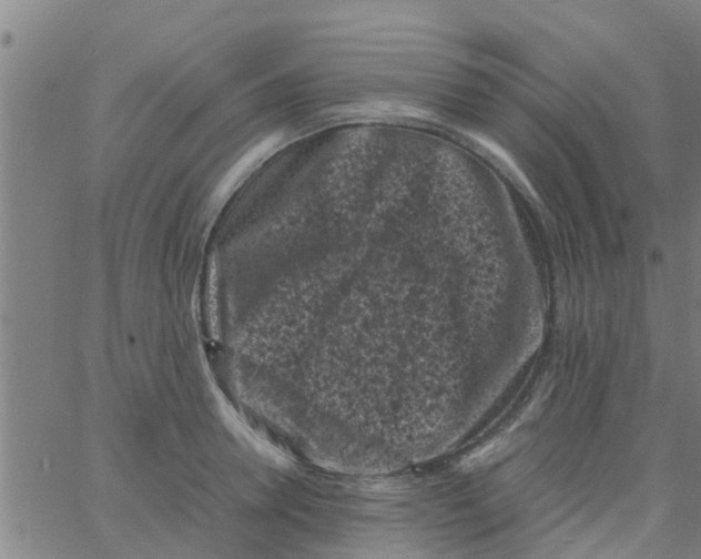 X0000066100946200603312022