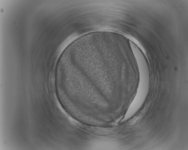 X0000066101007200603312020