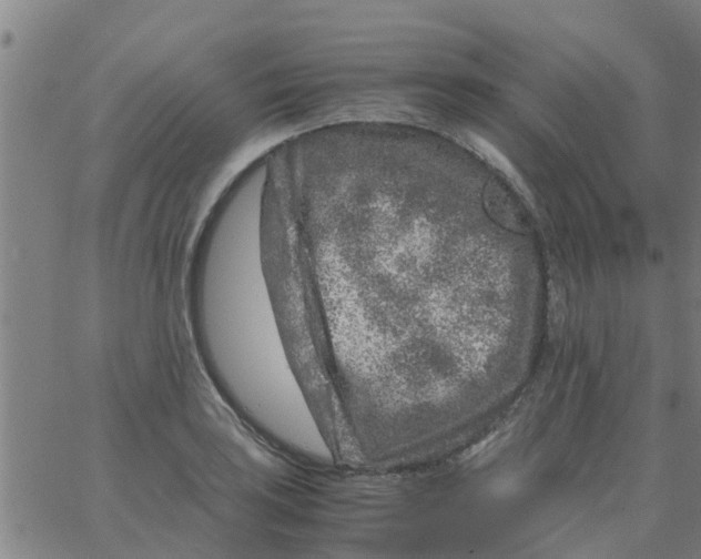 X0000066101035200603312020