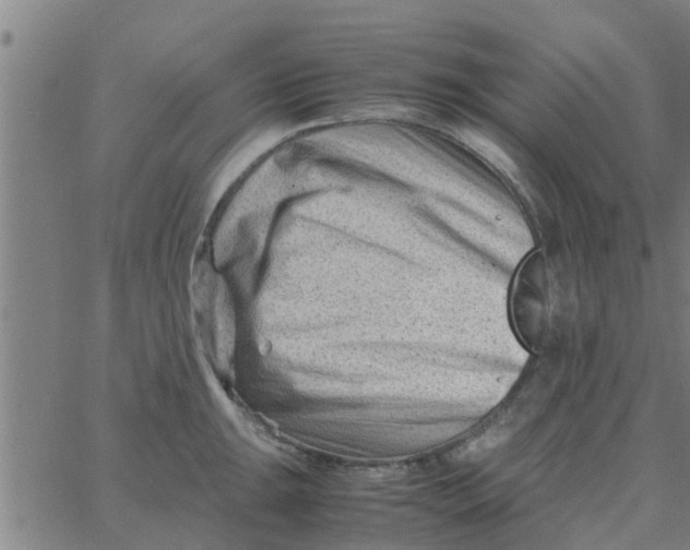 X0000066101047200603312020