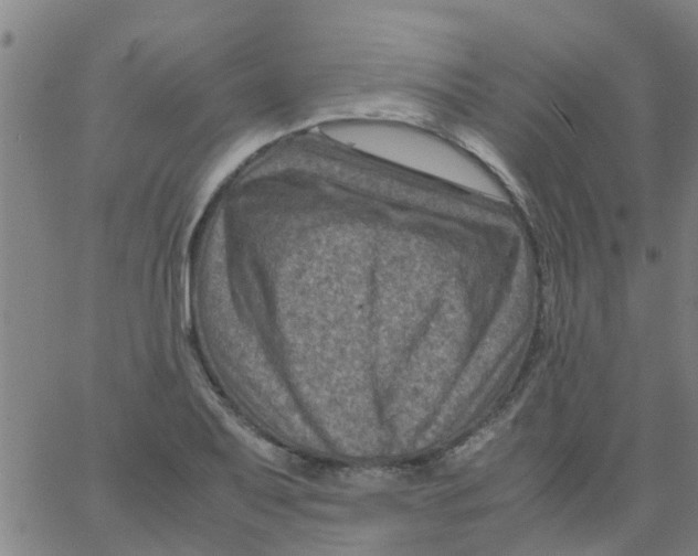 X0000066101079200603312019