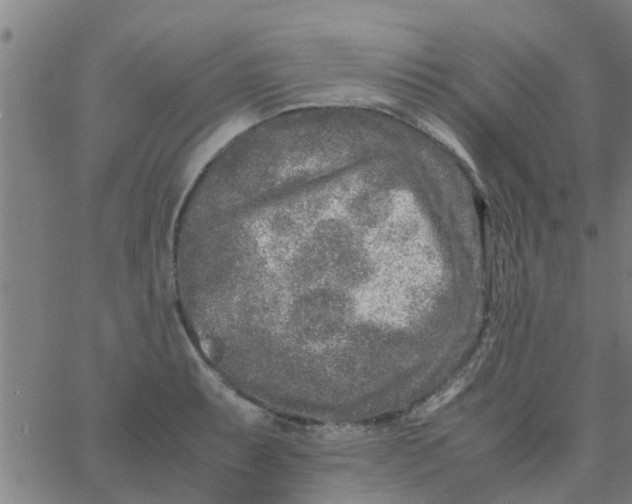 X0000066101087200603312019