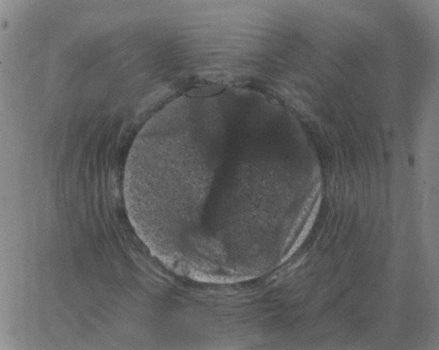 X0000066101106200603312018