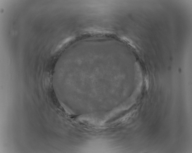 X0000066101157200603312018