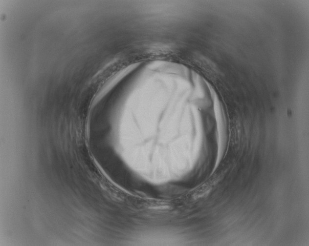 X0000066101158200603312018