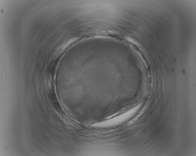 X0000066101161200603312018