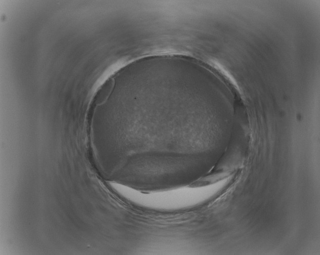 X0000066101173200603312018