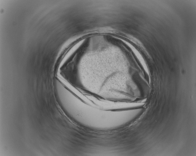 X0000066101176200603312017