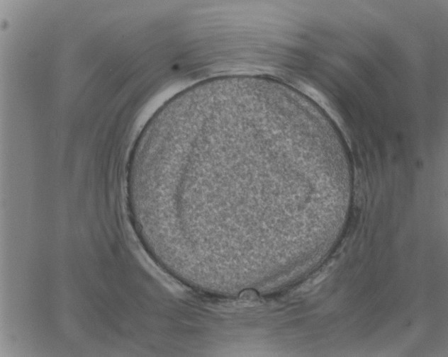 X0000066101187200603312017