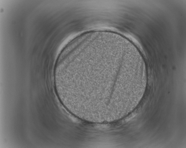 X0000066101191200603312017