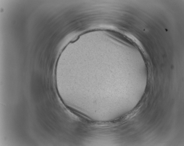 X0000066101199200603312017